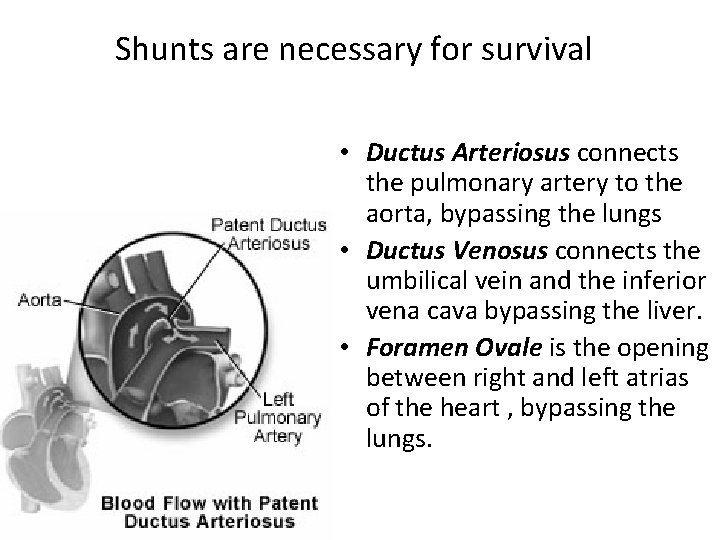 Shunts are necessary for survival • Ductus Arteriosus connects the pulmonary artery to the
