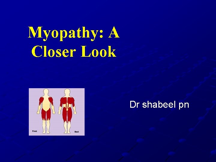 Myopathy: A Closer Look Dr shabeel pn 