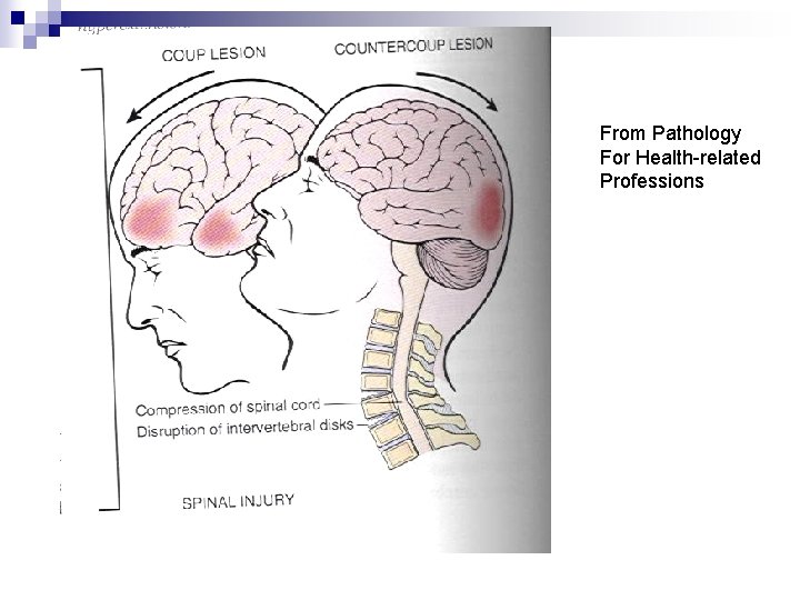 From Pathology For Health-related Professions 