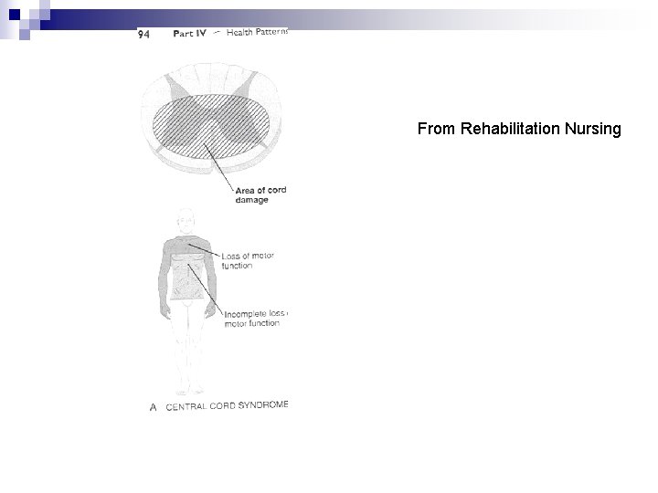 From Rehabilitation Nursing 