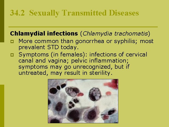 34. 2 Sexually Transmitted Diseases Chlamydial infections (Chlamydia trachomatis) p More common than gonorrhea