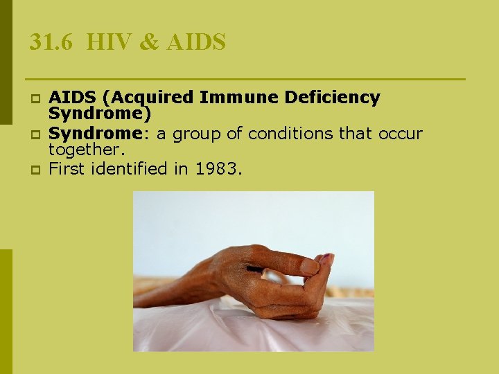 31. 6 HIV & AIDS p p p AIDS (Acquired Immune Deficiency Syndrome) Syndrome: