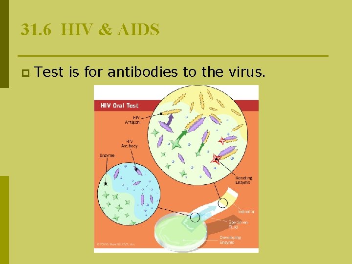 31. 6 HIV & AIDS p Test is for antibodies to the virus. 