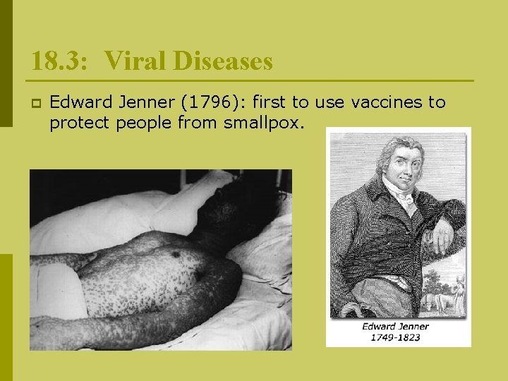 18. 3: Viral Diseases p Edward Jenner (1796): first to use vaccines to protect
