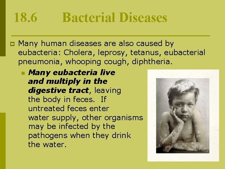 18. 6 p Bacterial Diseases Many human diseases are also caused by eubacteria: Cholera,