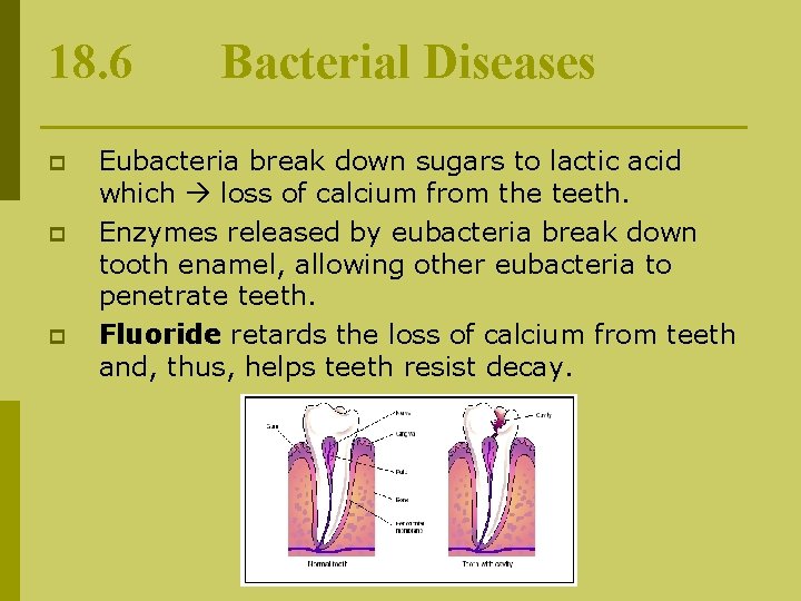 18. 6 p p p Bacterial Diseases Eubacteria break down sugars to lactic acid