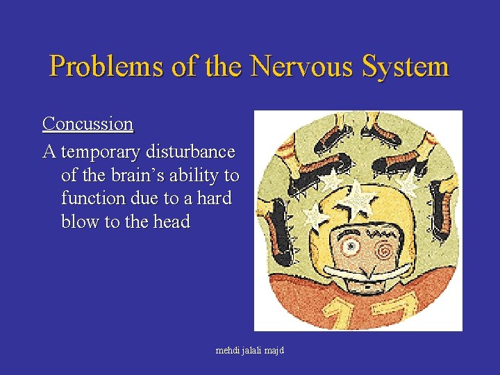 Problems of the Nervous System Concussion A temporary disturbance of the brain’s ability to