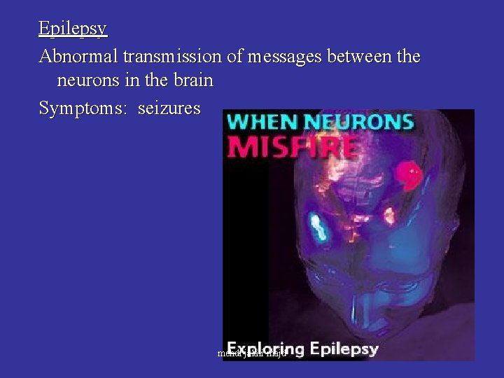 Epilepsy Abnormal transmission of messages between the neurons in the brain Symptoms: seizures mehdi