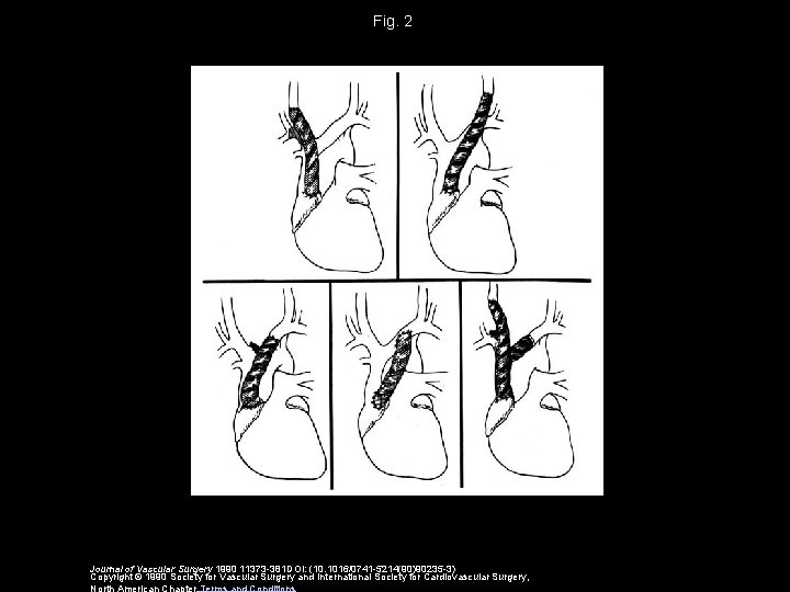 Fig. 2 Journal of Vascular Surgery 1990 11373 -381 DOI: (10. 1016/0741 -5214(90)90235 -3)