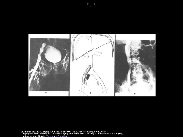 Fig. 3 Journal of Vascular Surgery 1990 11373 -381 DOI: (10. 1016/0741 -5214(90)90235 -3)