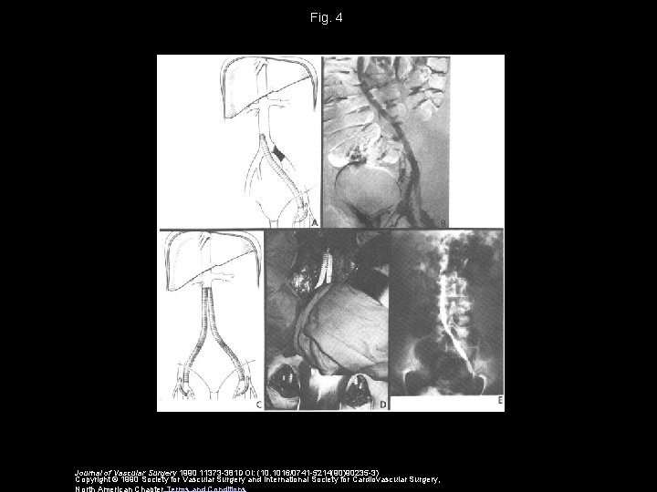 Fig. 4 Journal of Vascular Surgery 1990 11373 -381 DOI: (10. 1016/0741 -5214(90)90235 -3)