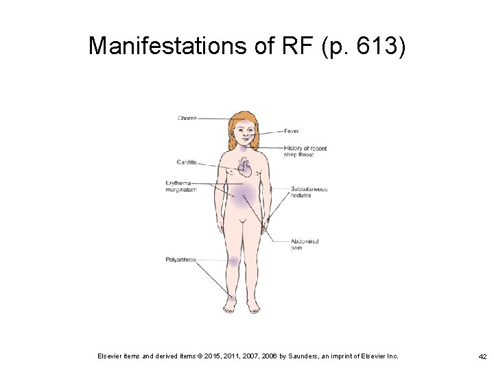 Manifestations of RF (p. 613) Elsevier items and derived items © 2015, 2011, 2007,