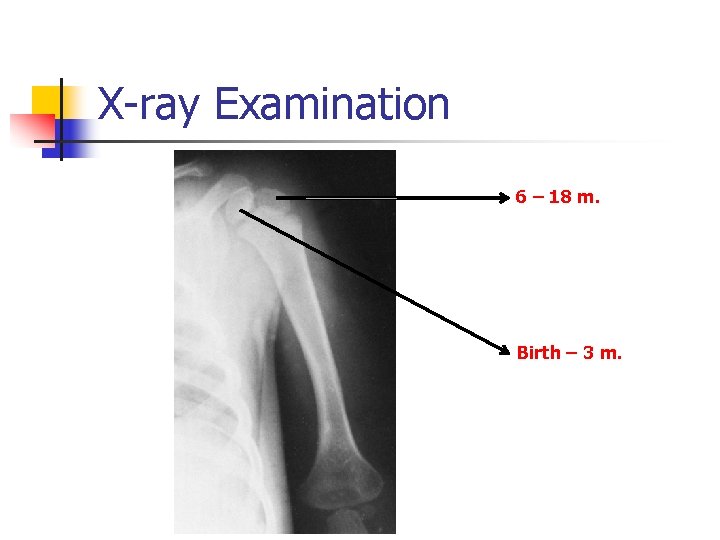 X-ray Examination 6 – 18 m. Birth – 3 m. 