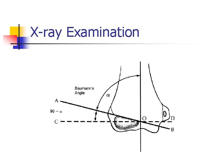 X-ray Examination 
