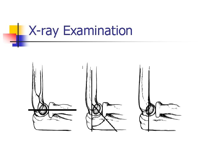 X-ray Examination 