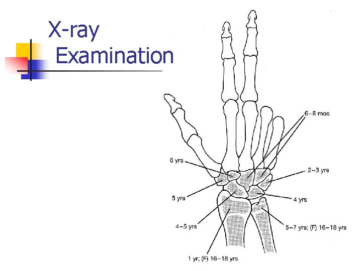 X-ray Examination 