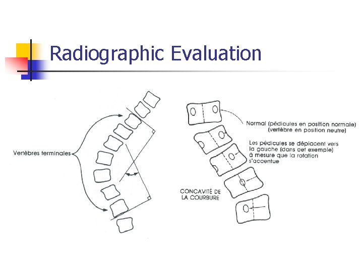 Radiographic Evaluation 