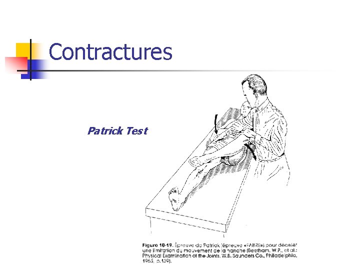 Contractures Patrick Test 