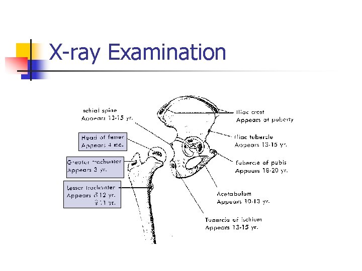X-ray Examination 