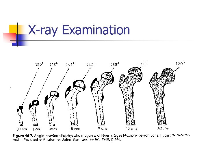 X-ray Examination 