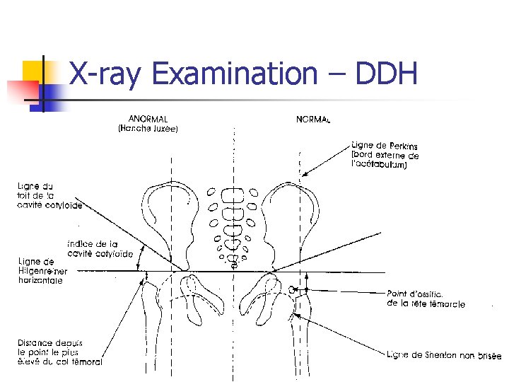 X-ray Examination – DDH 