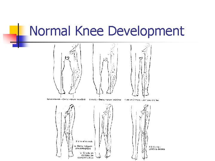 Normal Knee Development 