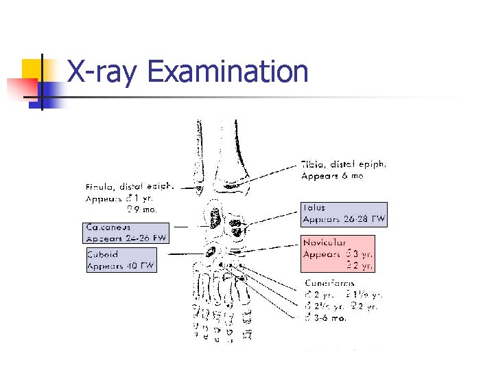 X-ray Examination 