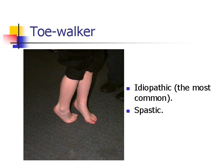 Toe-walker n n Idiopathic (the most common). Spastic. 