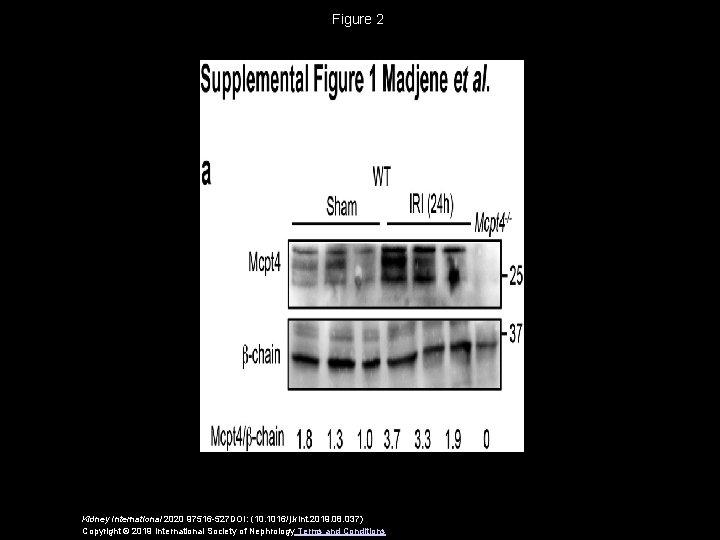 Figure 2 Kidney International 2020 97516 -527 DOI: (10. 1016/j. kint. 2019. 08. 037)