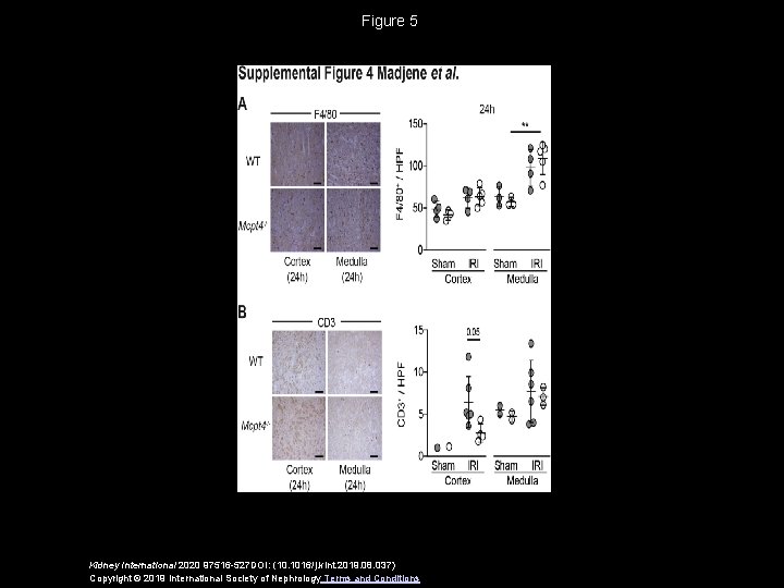 Figure 5 Kidney International 2020 97516 -527 DOI: (10. 1016/j. kint. 2019. 08. 037)