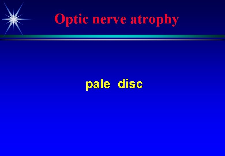 Optic nerve atrophy pale disc 