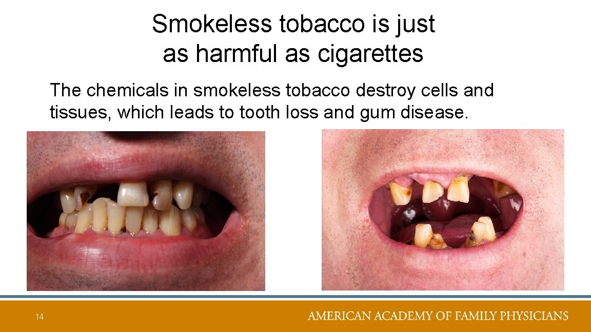 Smokeless tobacco is just as harmful as cigarettes The chemicals in smokeless tobacco destroy