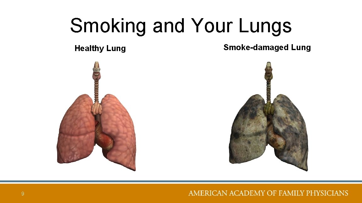 Smoking and Your Lungs Healthy Lung 9 Smoke-damaged Lung 