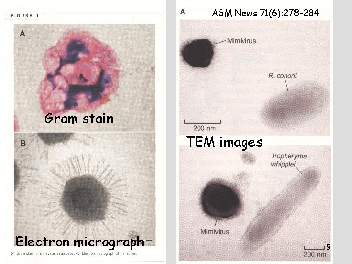ASM News 71(6): 278 -284 Gram stain TEM images Electron micrograph 9 ASM News 71(6): 278 -284 Gram stain TEM images Electron micrograph 9