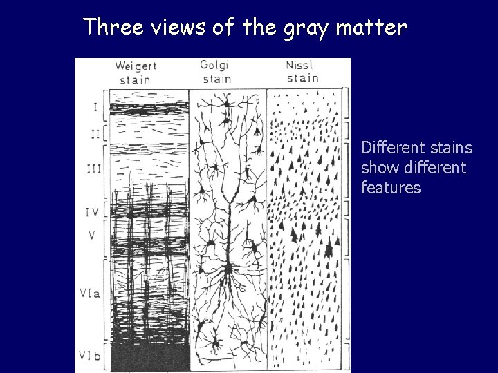 Three views of the gray matter Different stains show different features 