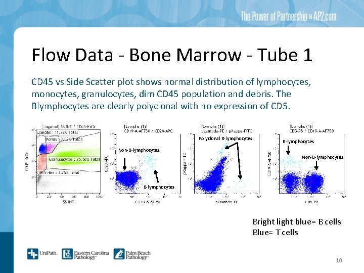 Flow Data - Bone Marrow - Tube 1 CD 45 vs Side Scatter plot