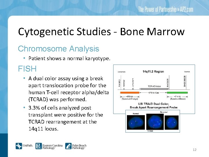 Cytogenetic Studies - Bone Marrow Chromosome Analysis • Patient shows a normal karyotype. FISH