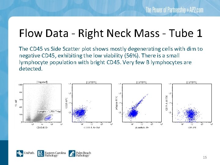 Flow Data - Right Neck Mass - Tube 1 The CD 45 vs Side