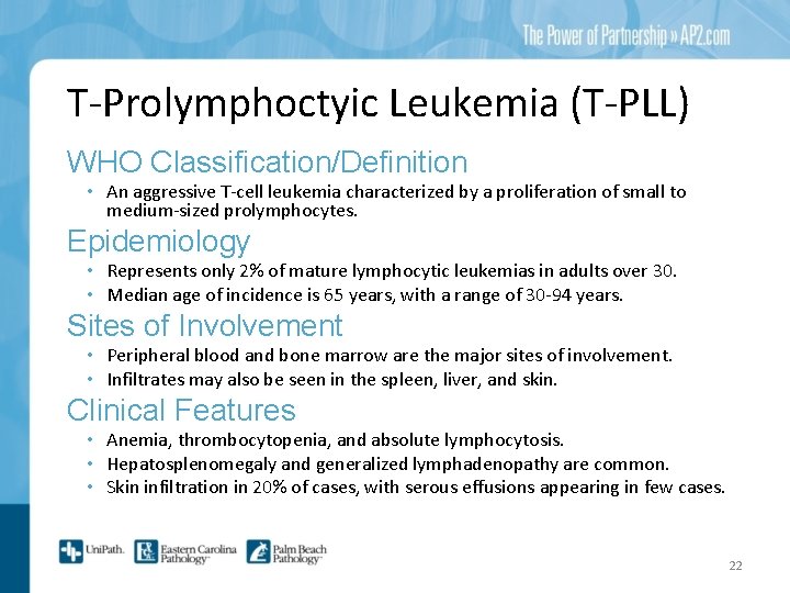 T-Prolymphoctyic Leukemia (T-PLL) WHO Classification/Definition • An aggressive T-cell leukemia characterized by a proliferation