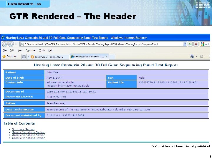 Haifa Research Lab GTR Rendered – The Header Draft that has not been clinically