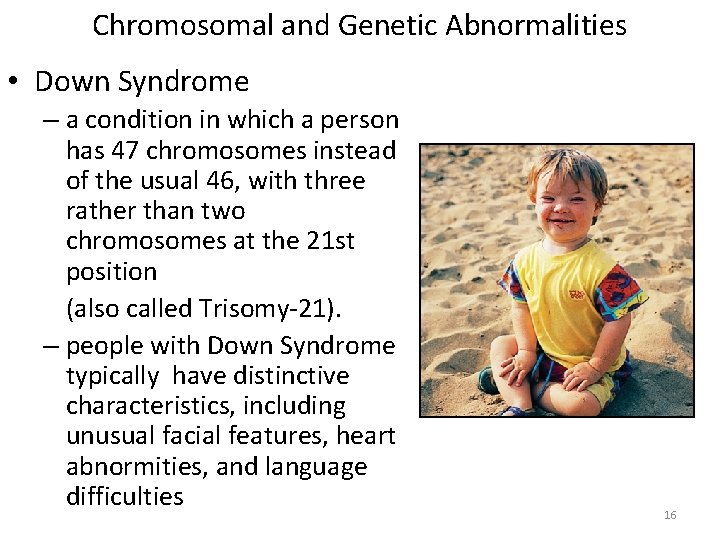 Chromosomal and Genetic Abnormalities • Down Syndrome – a condition in which a person
