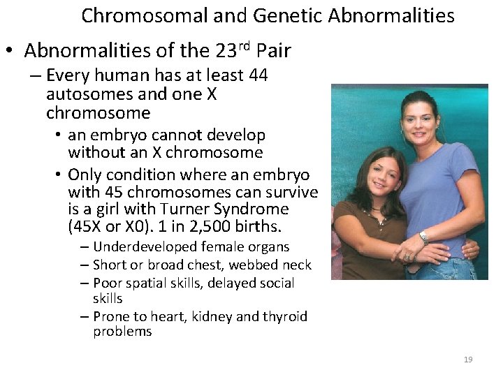 Chromosomal and Genetic Abnormalities • Abnormalities of the 23 rd Pair – Every human