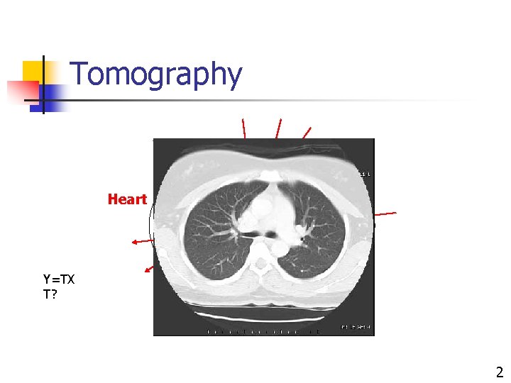 Tomography Heart Y=TX T? 2 Tomography Heart Y=TX T? 2