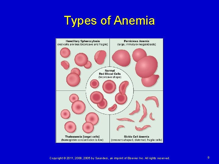 Types of Anemia Copyright © 2011, 2008, 2005 by Saunders, an imprint of Elsevier