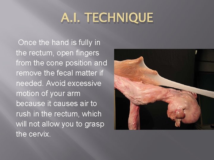 A. I. TECHNIQUE Once the hand is fully in the rectum, open fingers from