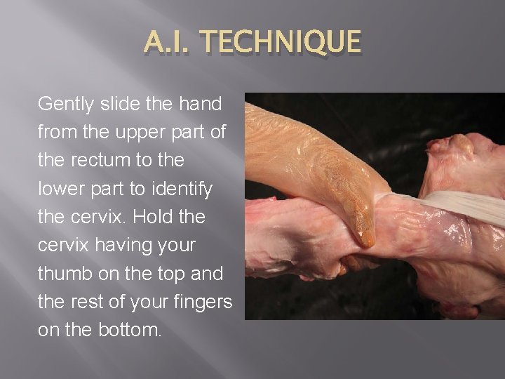 A. I. TECHNIQUE Gently slide the hand from the upper part of the rectum