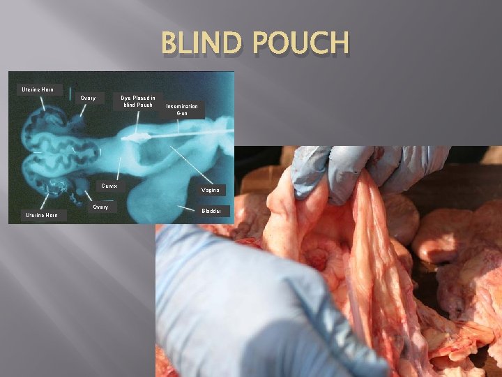 BLIND POUCH Uterine Horn Ovary Dye Placed in blind Pouch Cervix Ovary Uterine Horn