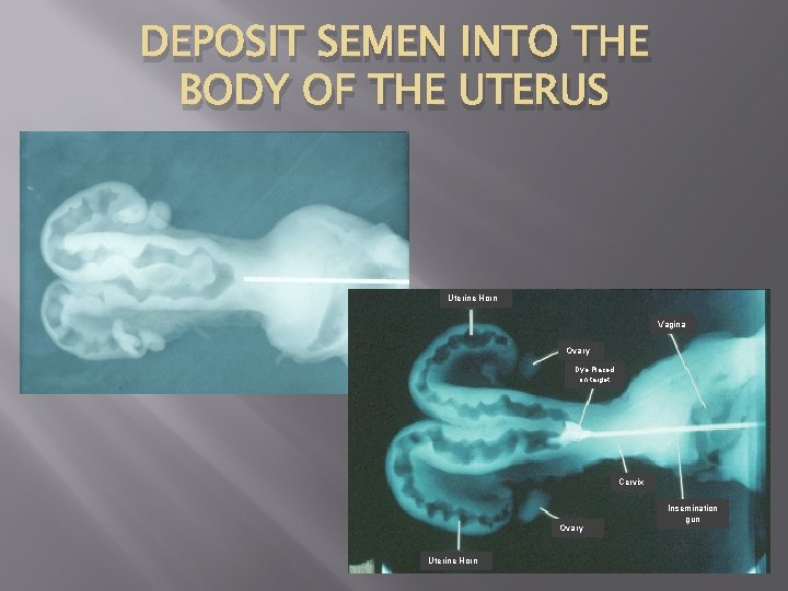 DEPOSIT SEMEN INTO THE BODY OF THE UTERUS Uterine Horn Vagina Ovary Dye Placed