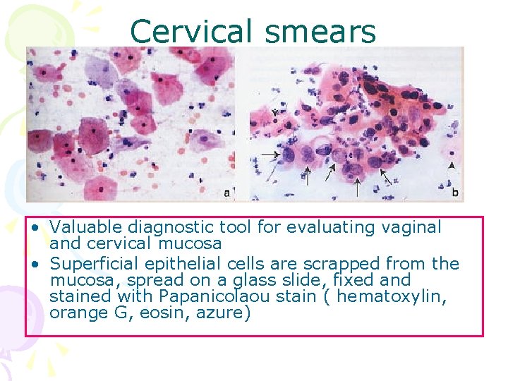 Cervical smears • Valuable diagnostic tool for evaluating vaginal and cervical mucosa • Superficial