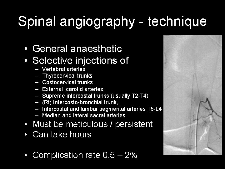 Spinal angiography - technique • General anaesthetic • Selective injections of – – – Spinal angiography - technique • General anaesthetic • Selective injections of – – –